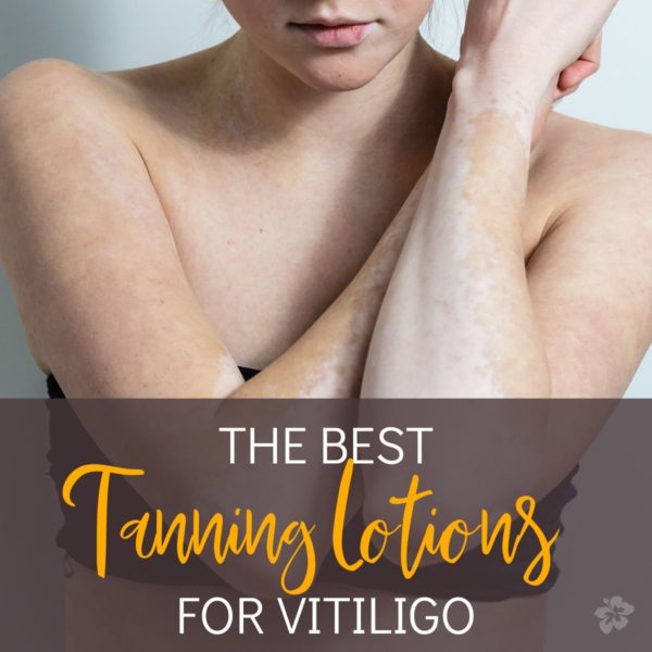 The Best Tanning Lotions for Vitiligo and Evening Skin Tone